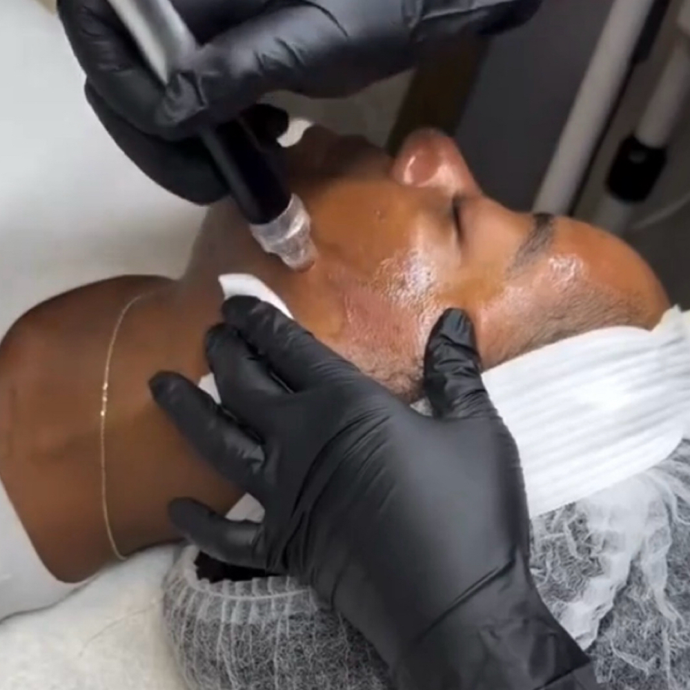 Micro HydroDermabrasion at Spatium Urgent Care & Wellness in Marietta, GA