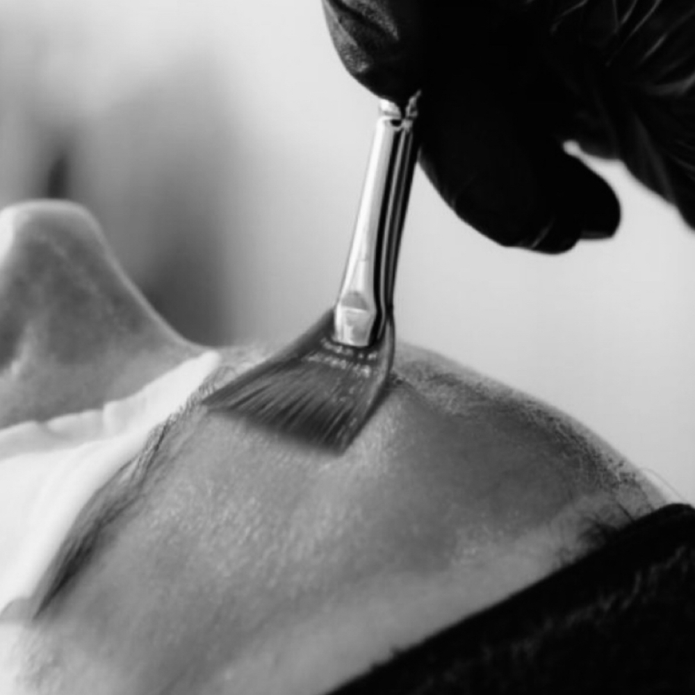 Chemical Peel (Stand-Alone) at Victoria Michelle Aesthetics LLC in Kings Park, NY