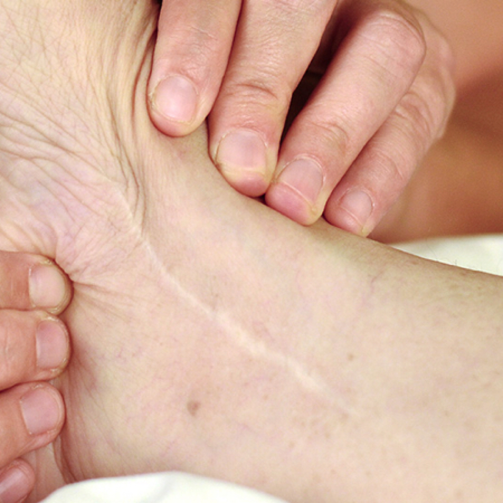 Scar Tissue Release Massage at Savage Massage Therapy in Culpeper, VA