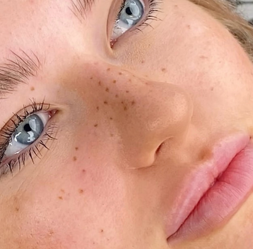 FRECKLE TATTOOS