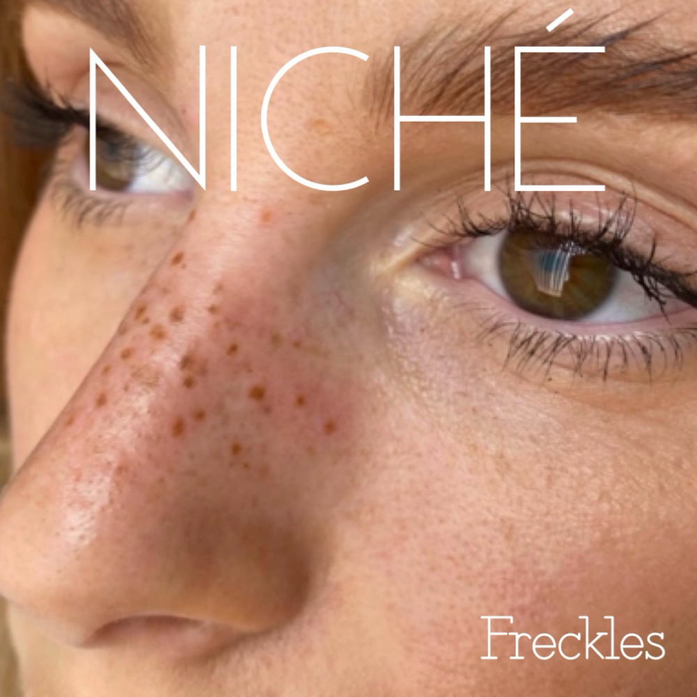 FRECKLES at NICHÉ in Lewisville, TX