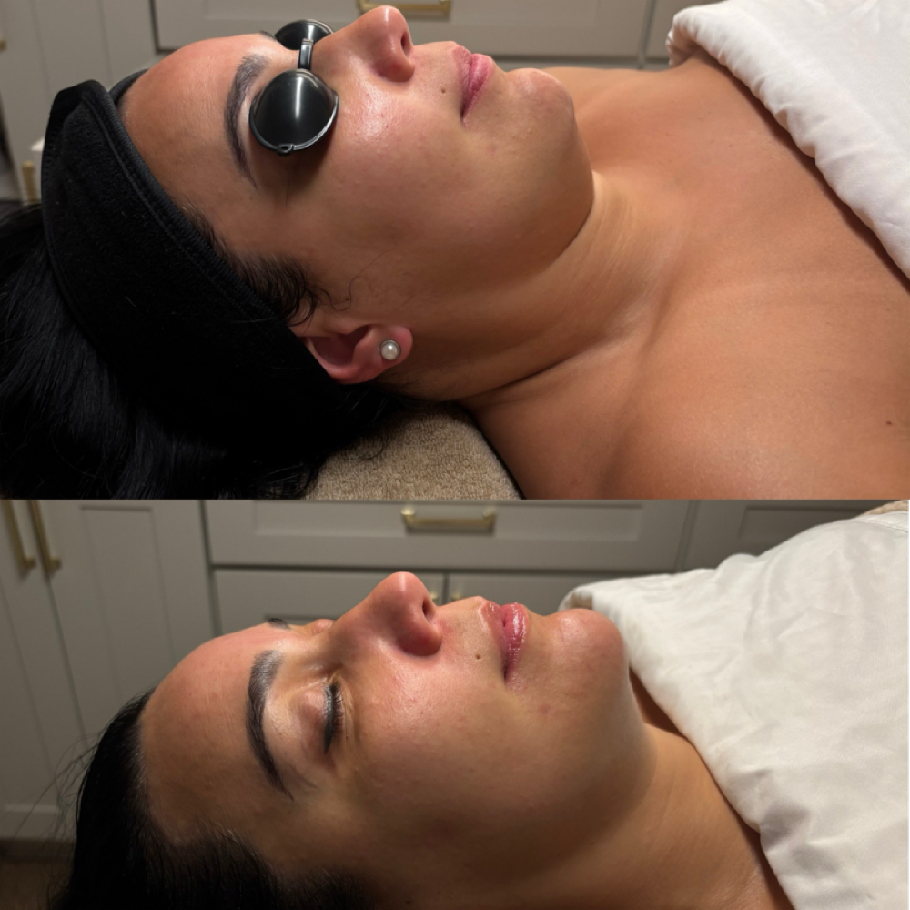 LYMPHATIC RESTORE FACIAL at FACE2FACE SKIN STUDIO in Kew Gardens, NY