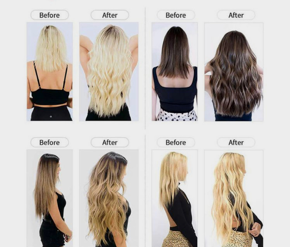 Extentions