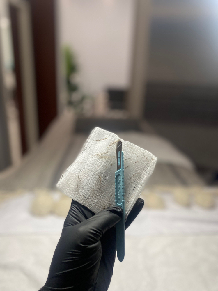Dermaplane Facial