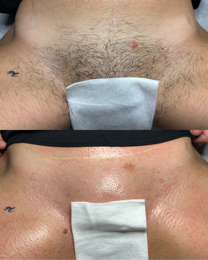 Brazilian Wax at ShoMeBeauty in Saint Joseph, MO