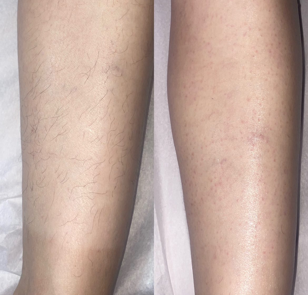 Leg Wax