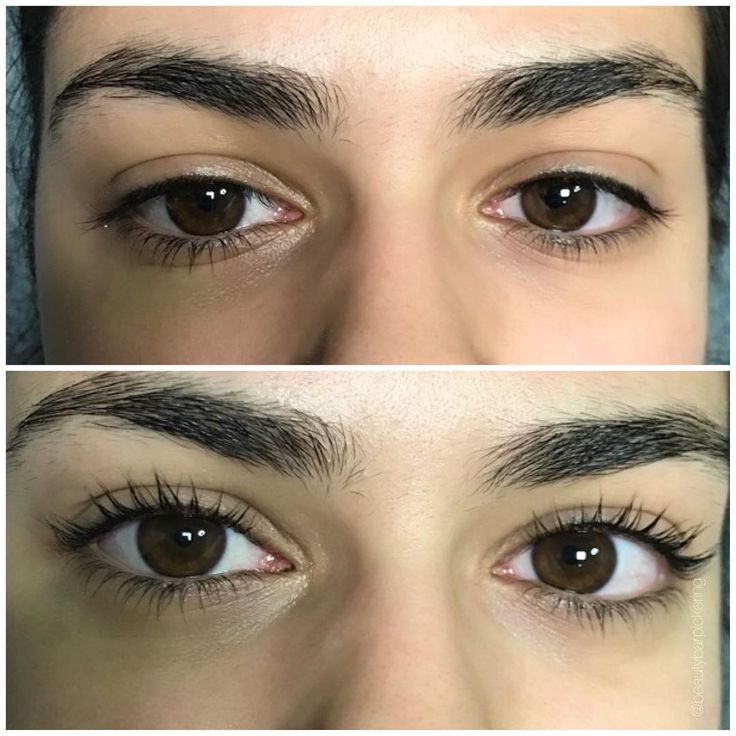 Lash Lift at Skin Therapy LLC in Lincolnton, NC