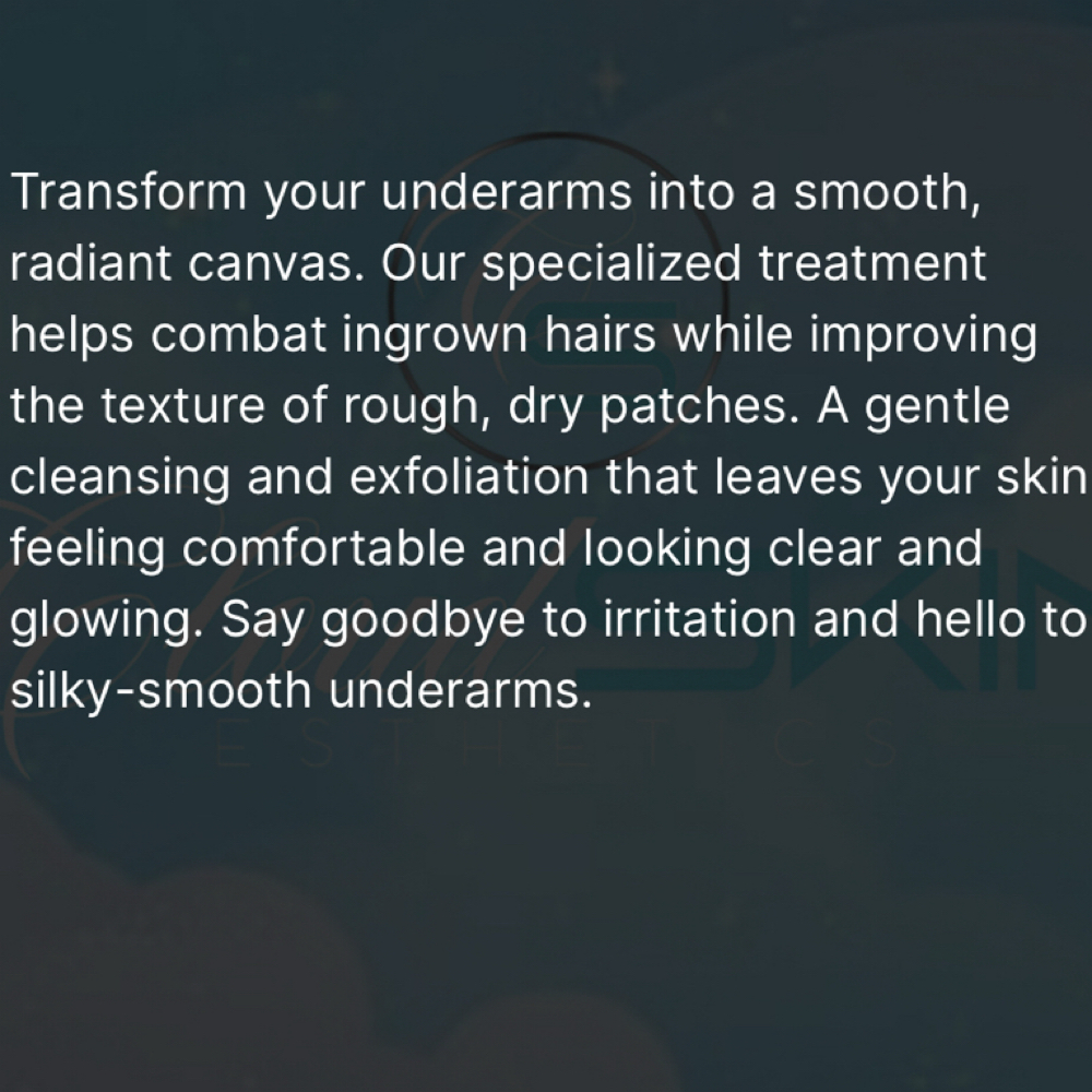 Pit Perfect Treatment at Cloud Skin Esthetics LLC. in Redford, MI