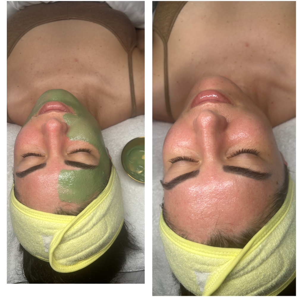 Detox Facial