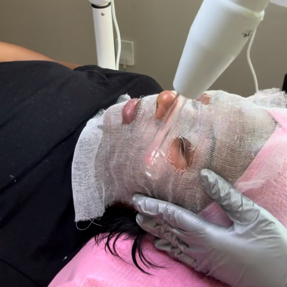 High Frequency at Self Love And Care Esthetic Lounge in Cedar Hill, TX