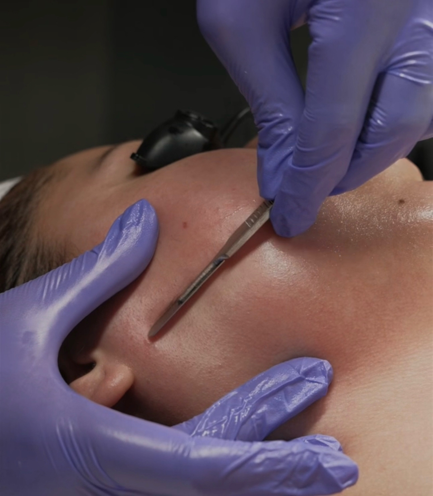 Signature Dermaplane Facial