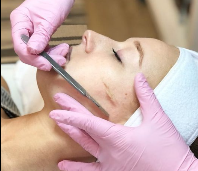 Dermaplane facial