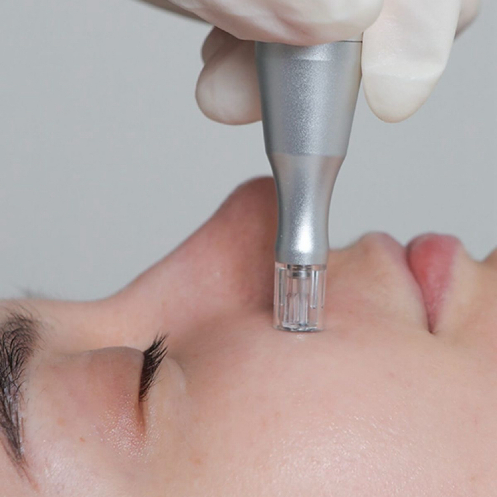 Nano Infusion Facial at NKD SKN Headspa + Esthetics in Lees Summit, MO