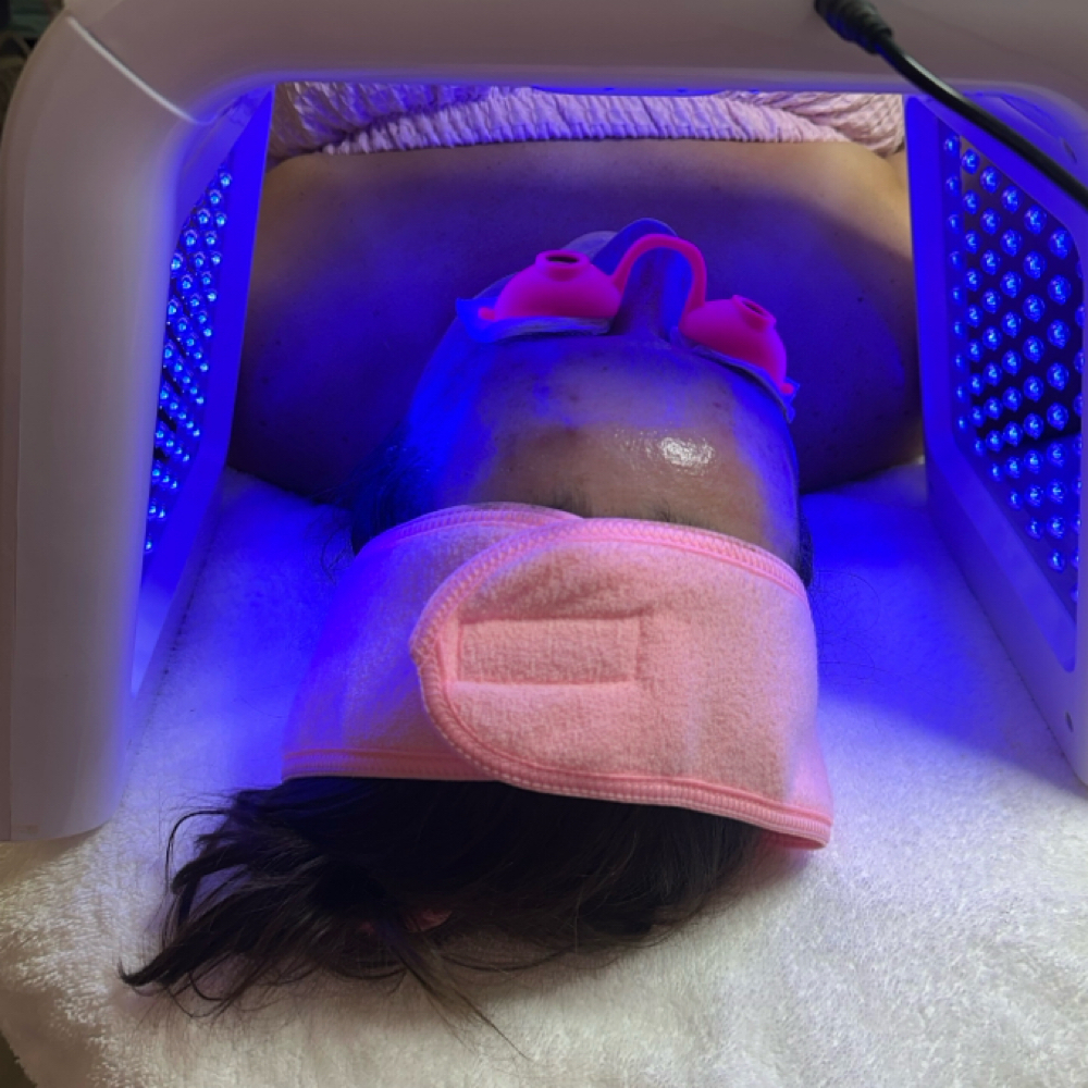 Acne Facial at Sandra the Esti LLC in Downers Grove, IL