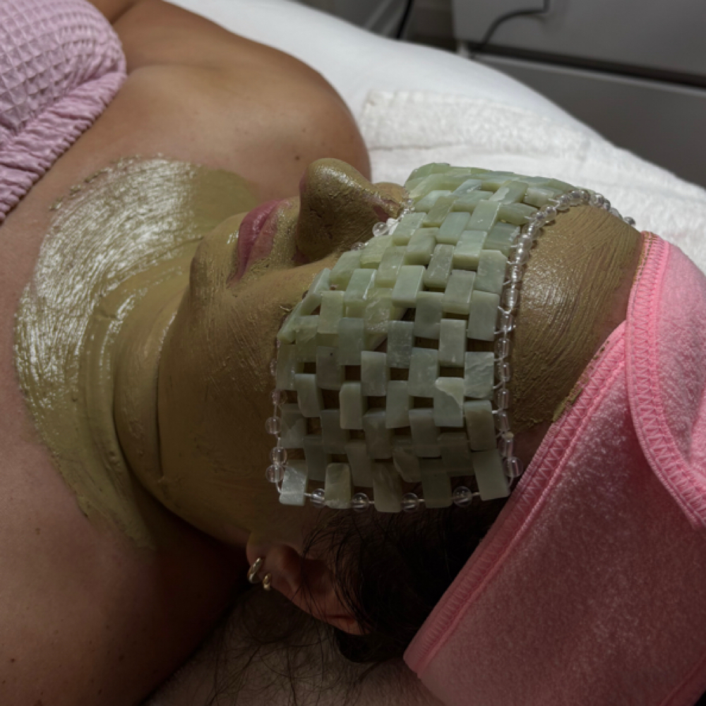 Acne Facial at Sandra the Esti LLC in Downers Grove, IL