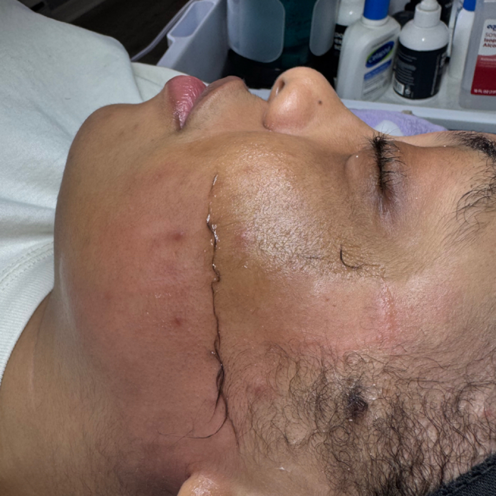 July’s Dermaplaning Facial Deal at Jewelina & Co in Brandon, FL