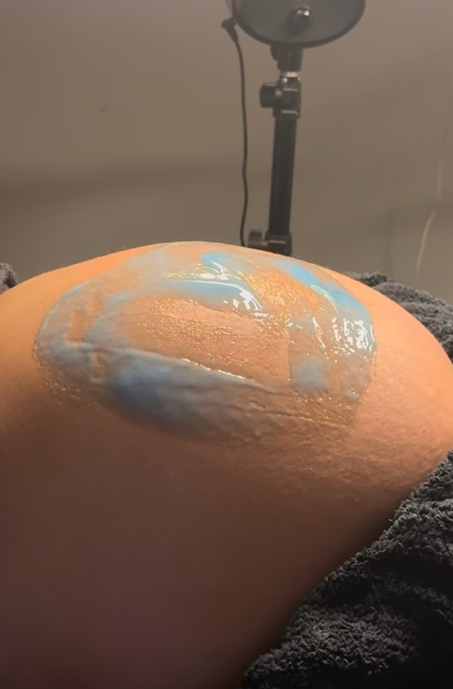 30 Min Baby Bump Facial