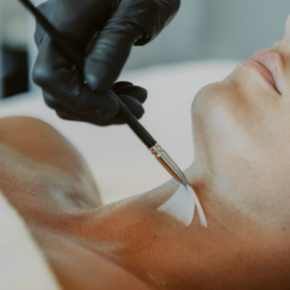 Body Chemical Peel at KNR Aesthetics in Brandon, FL