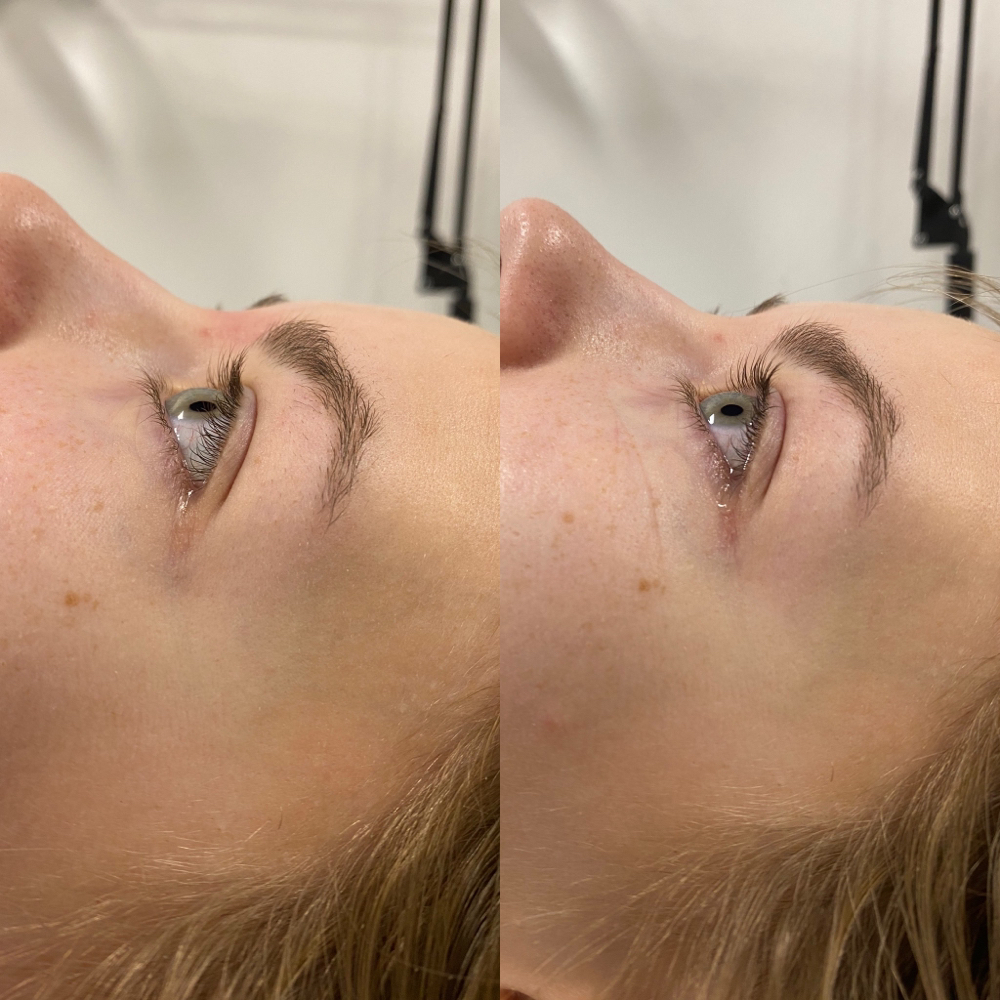 Lash Lift