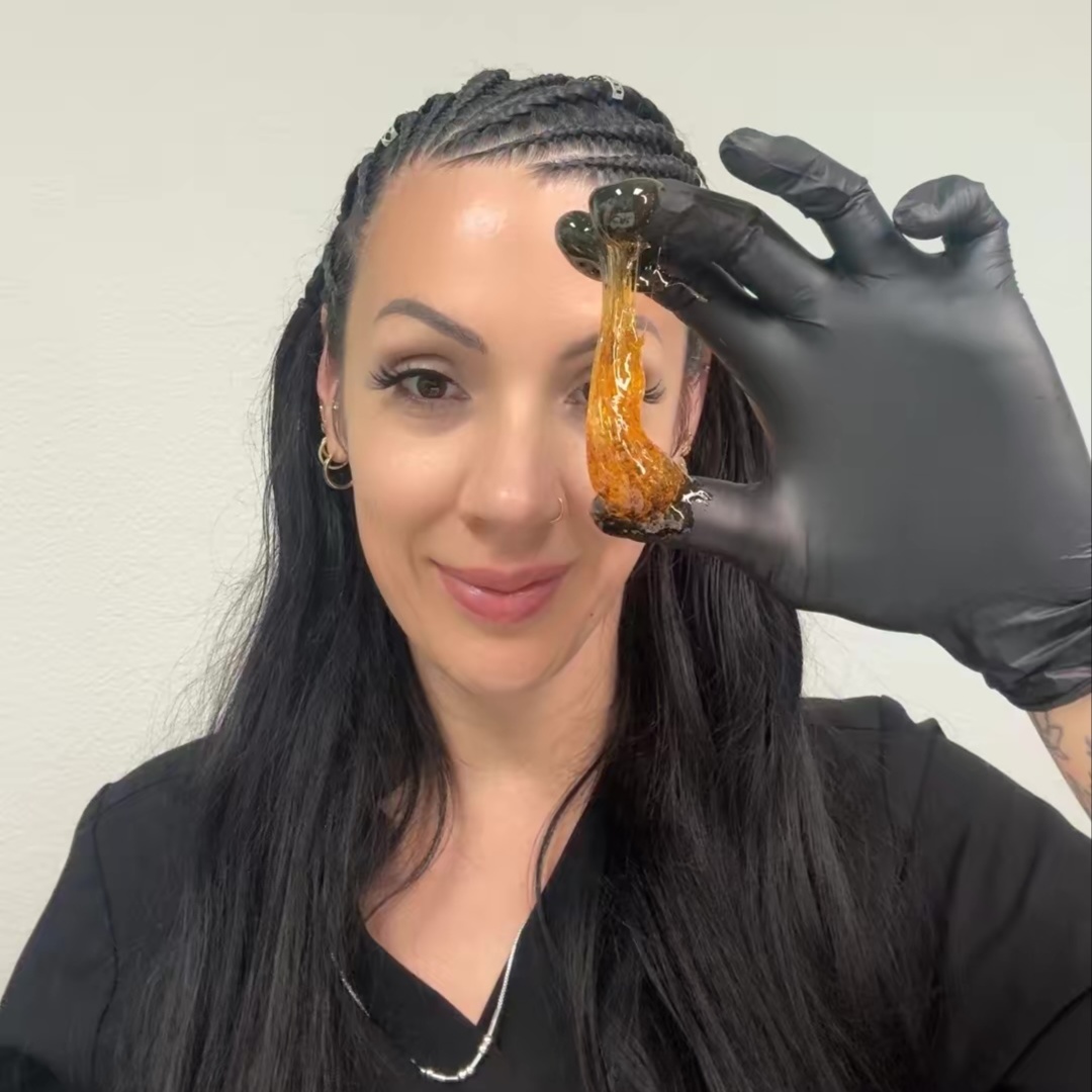 Chin Sugaring at Radiant Esthetics in Salem, OR