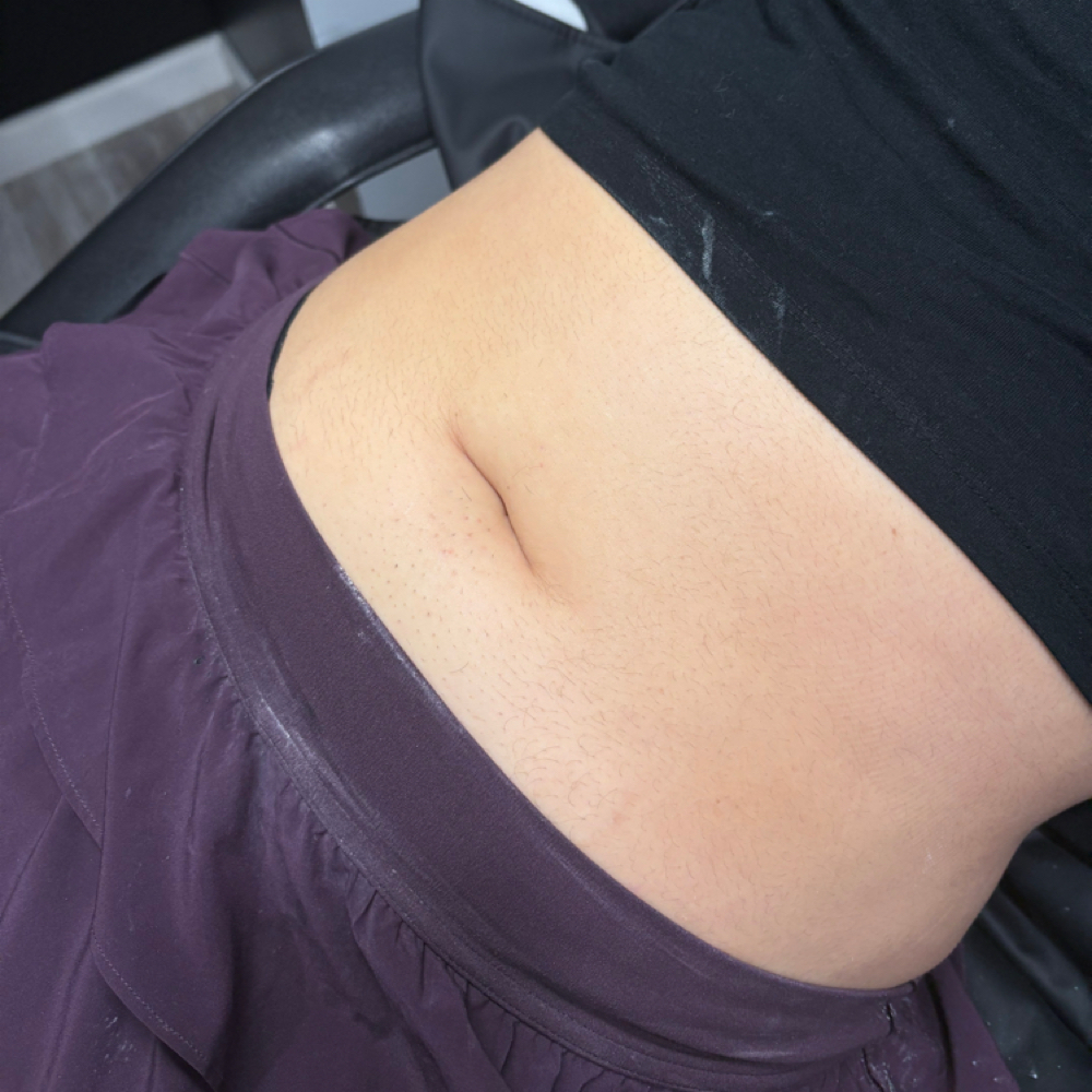 Stomach Strip: Happy Trail at Divine Uplift Beauty in Upon Booking, NY