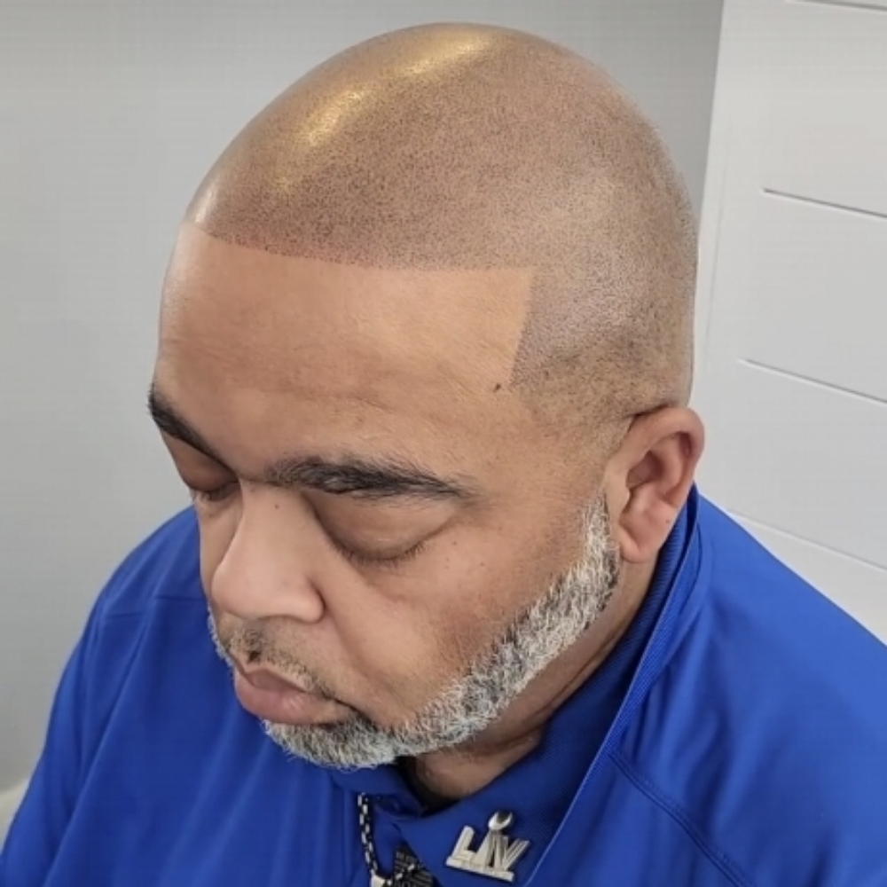 Scalp Micropigmentation at KC Permanent Makeup Academy & Studio in Apollo Beach, FL