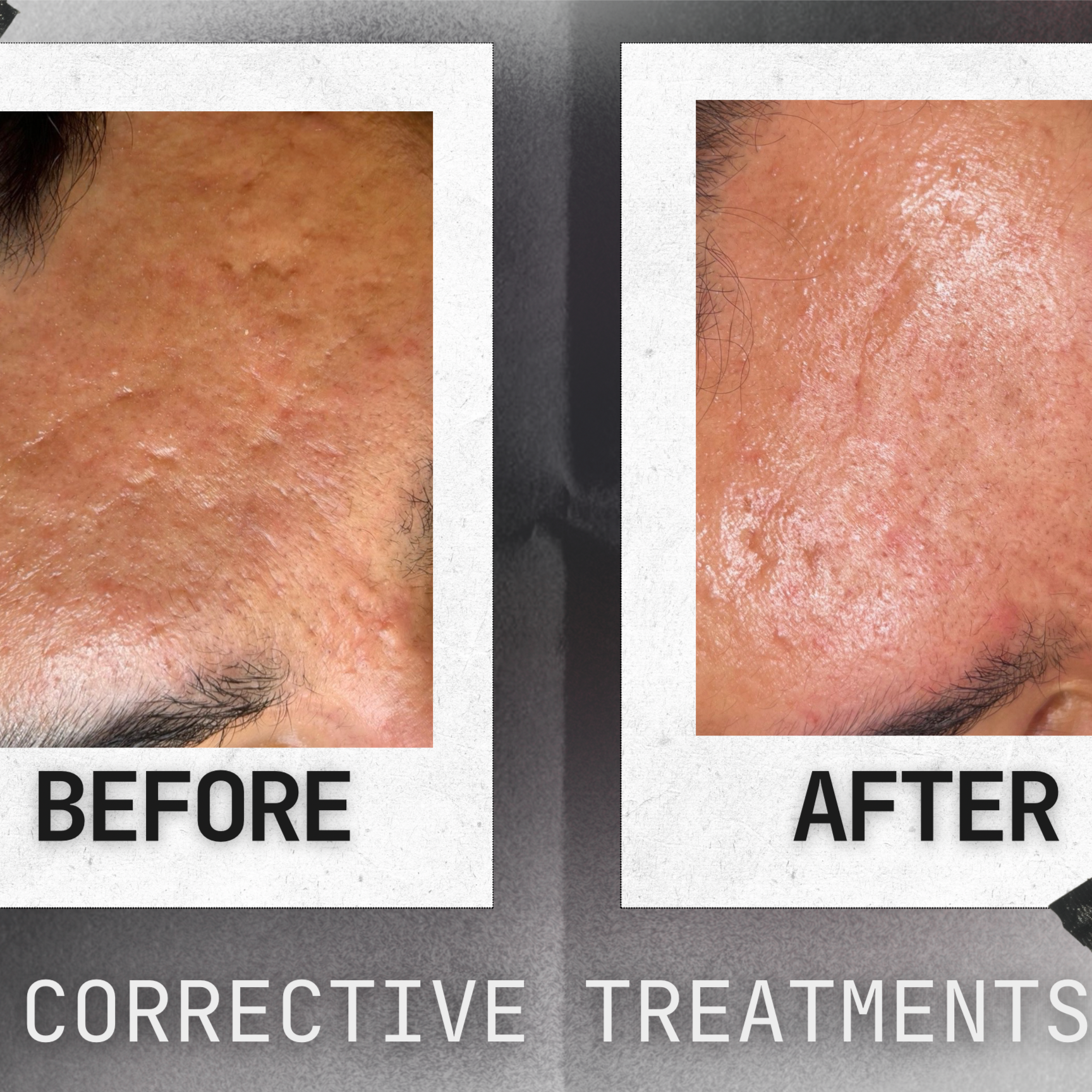 Advanced Corrective Facial at Love Beauty Lounge in Victorville, CA