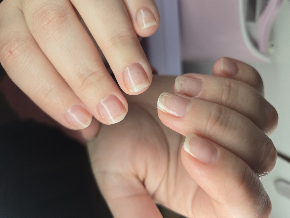 Nail Enhancements Removal