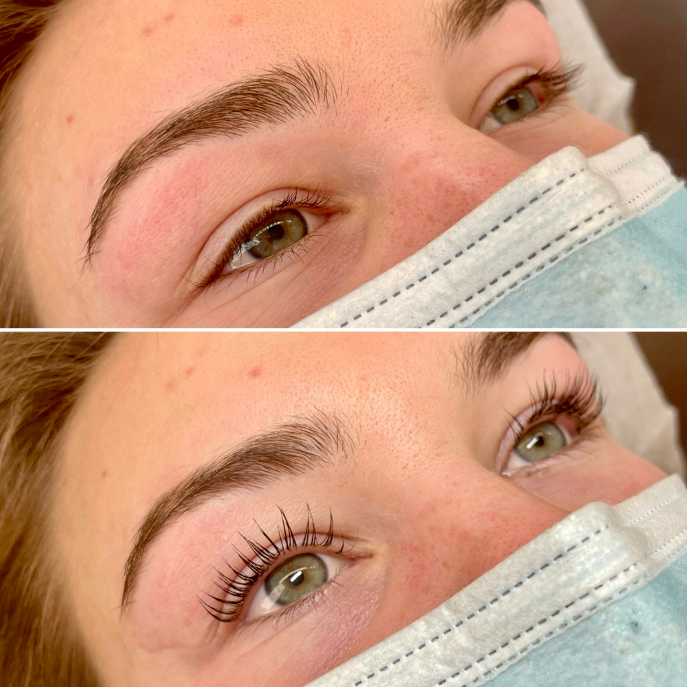 Lash Lift