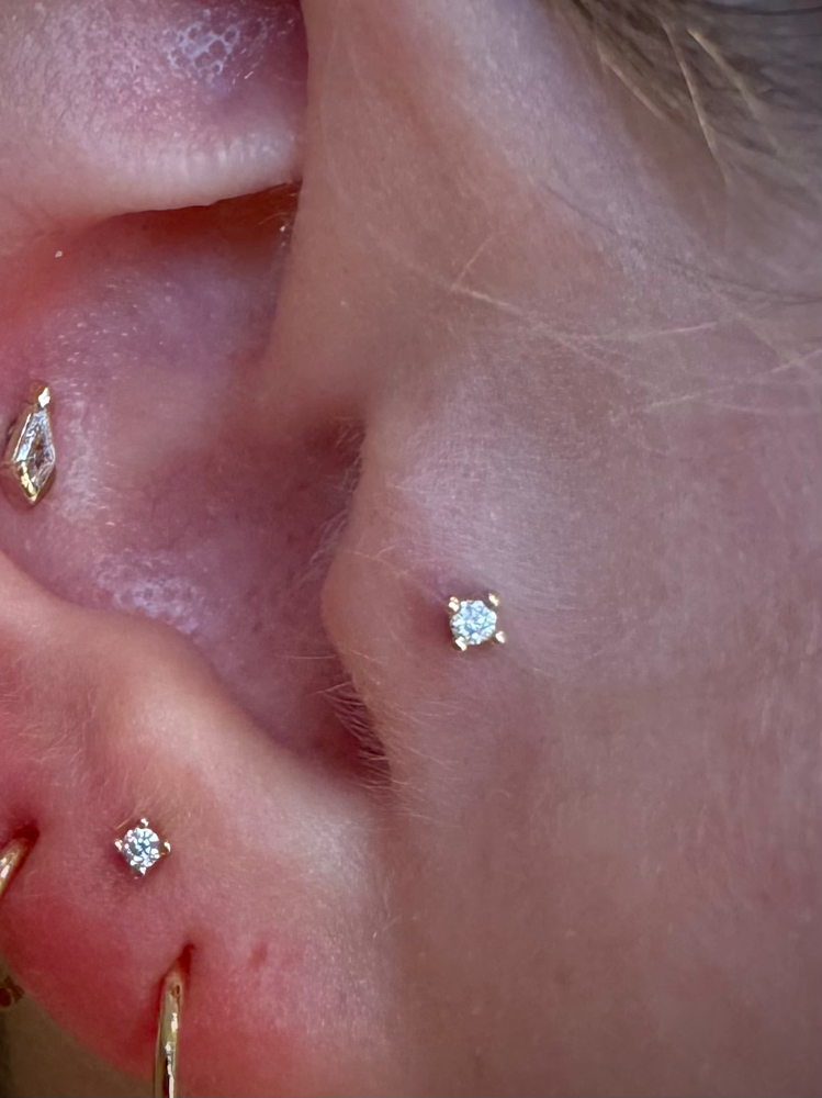 Tragus