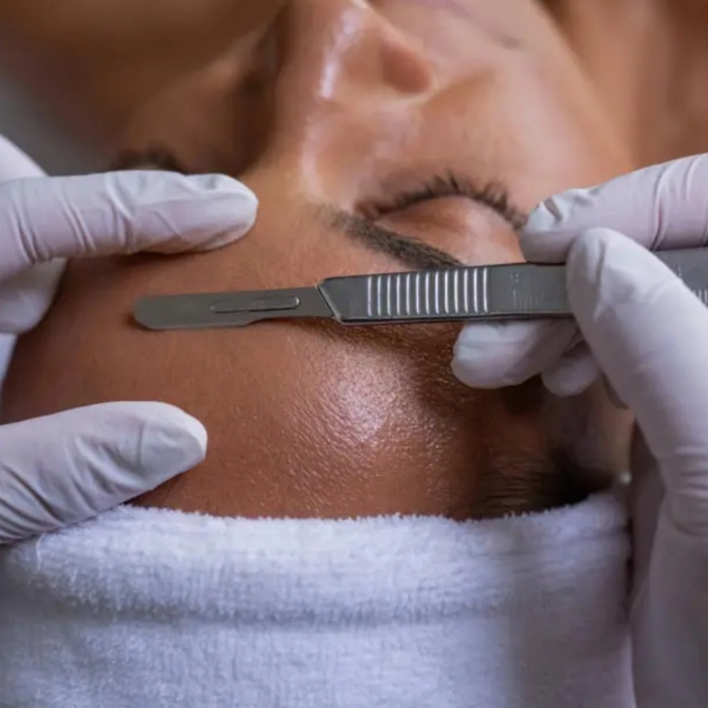 Dermaplaning at Glow Lab Aesthetics & Wellness, LLC in El Paso, TX