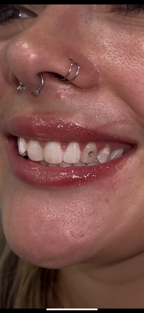 Tooth Gems
