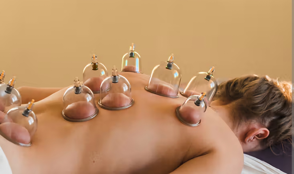 Add on Cupping