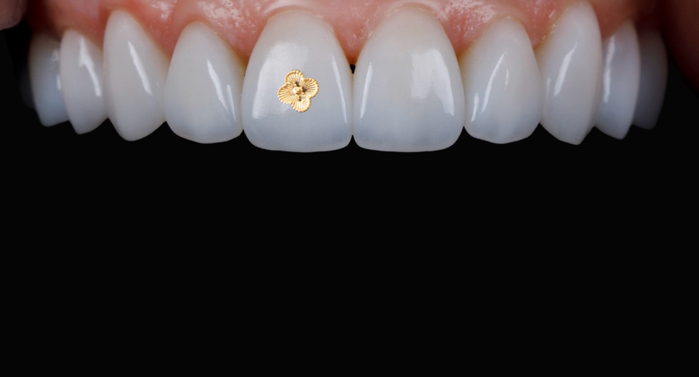 18k Gold Designer Charm