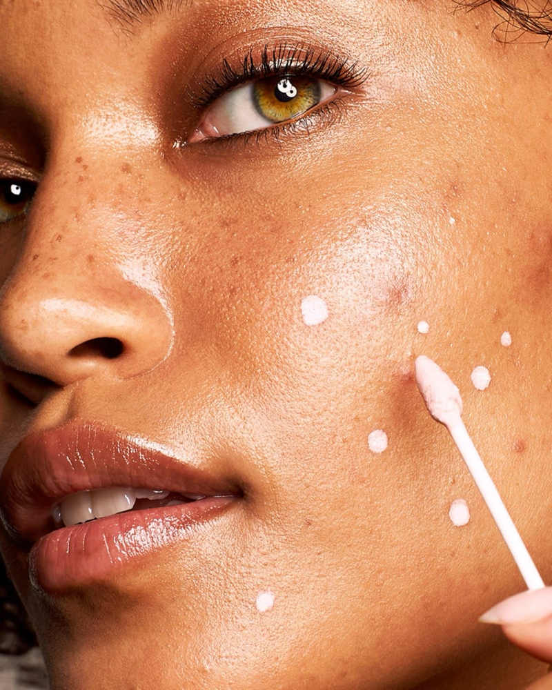 🔥 The Acne Clarity Ritual at Glow Gold Esthetics in Orlando, FL