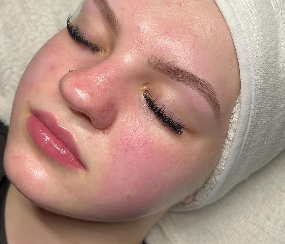 Basic Facial at Indy blinx in Indianapolis, IN