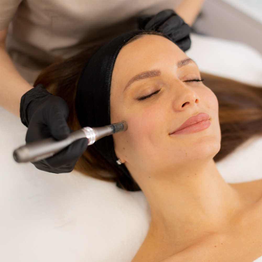 Microneedle at Lunar Beauty Suites in Logan, UT