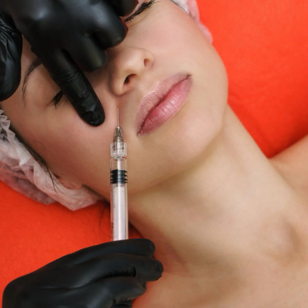SMILE LINE FILLER at Jay Michelle Aesthetics & Wellness in Lake Jackson, TX