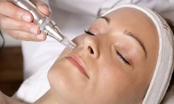 Nanoinfusion Facial