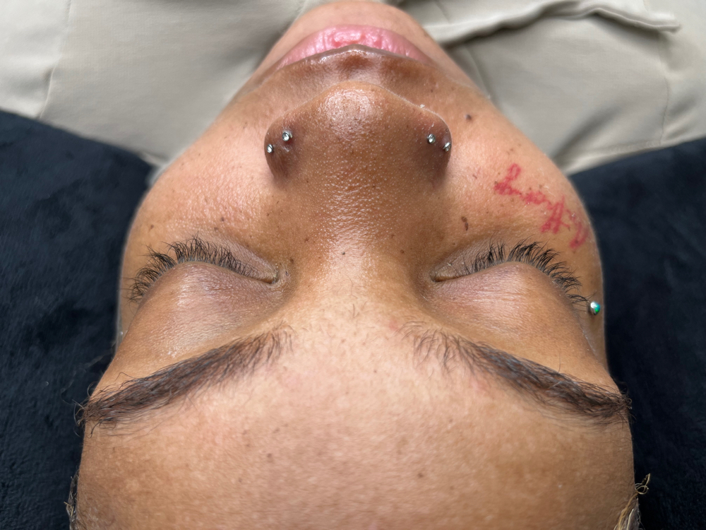 Lash Removal