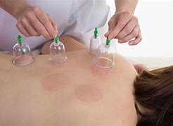 90 Minute Cupping Massage