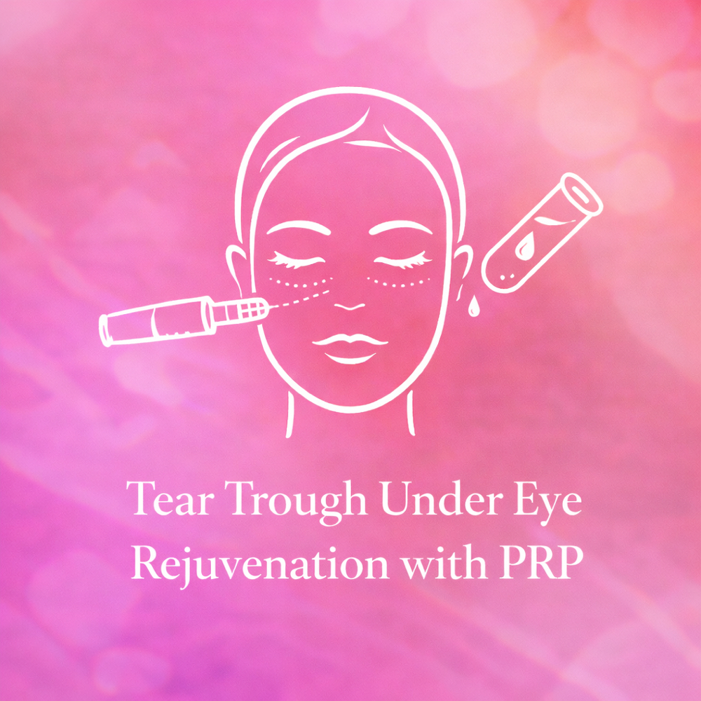 Undereye Rejuvenation With PRP Gel at The Aesthetics Lounge in Cordova, TN