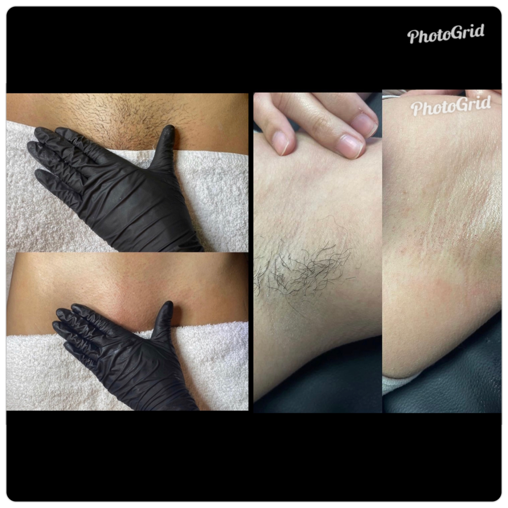 Brazilian And Underarms