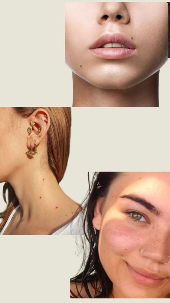Tattoo Freckles