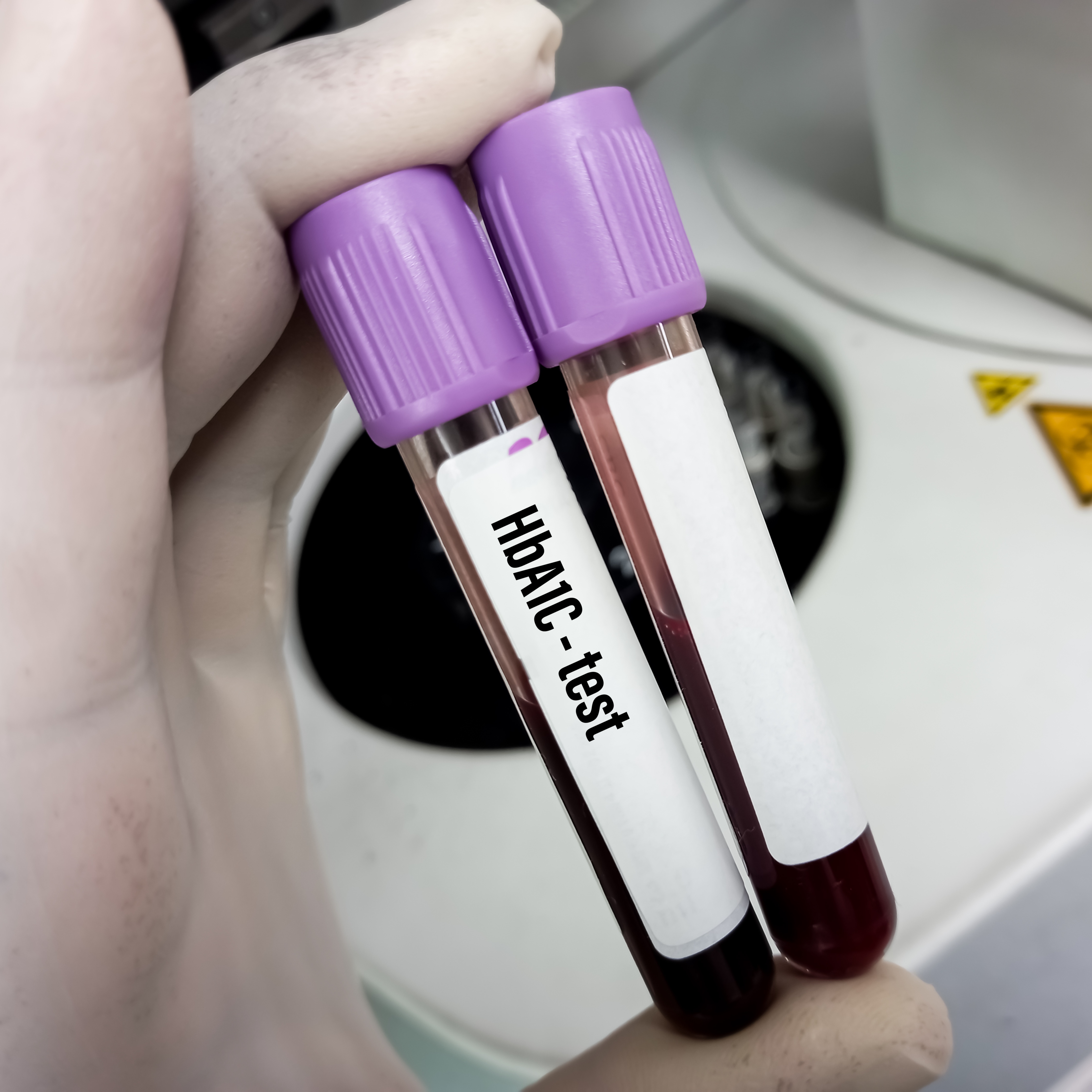 hemaglobin A1C at Give-A-Little More Lab Services & more in HOUSTON, TX