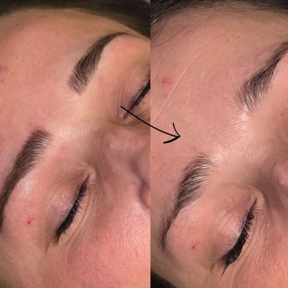 Nano Brows at Modern Skin New York in Rochester, NY