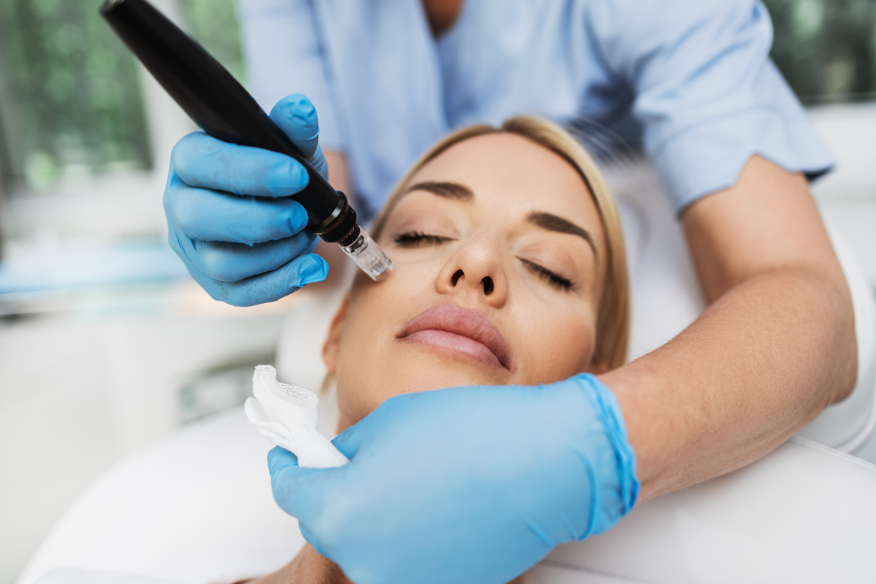 Microneedling Treatment