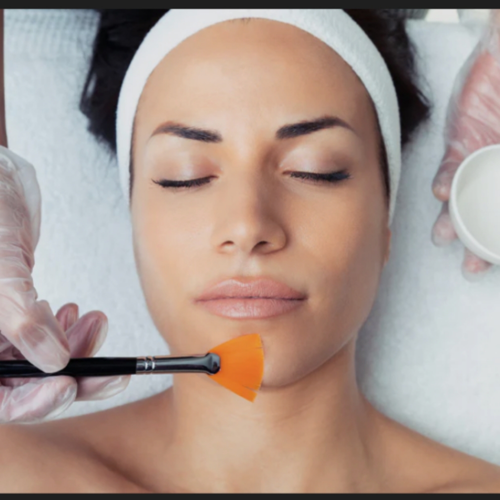 Chemical Peel Facial