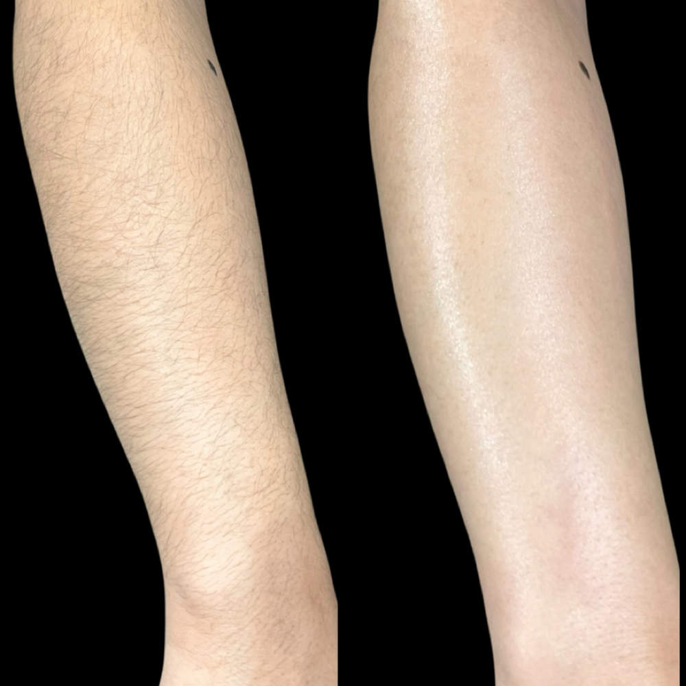 Half Arm Wax at Envious Smiles & Beauty in Rockford, IL