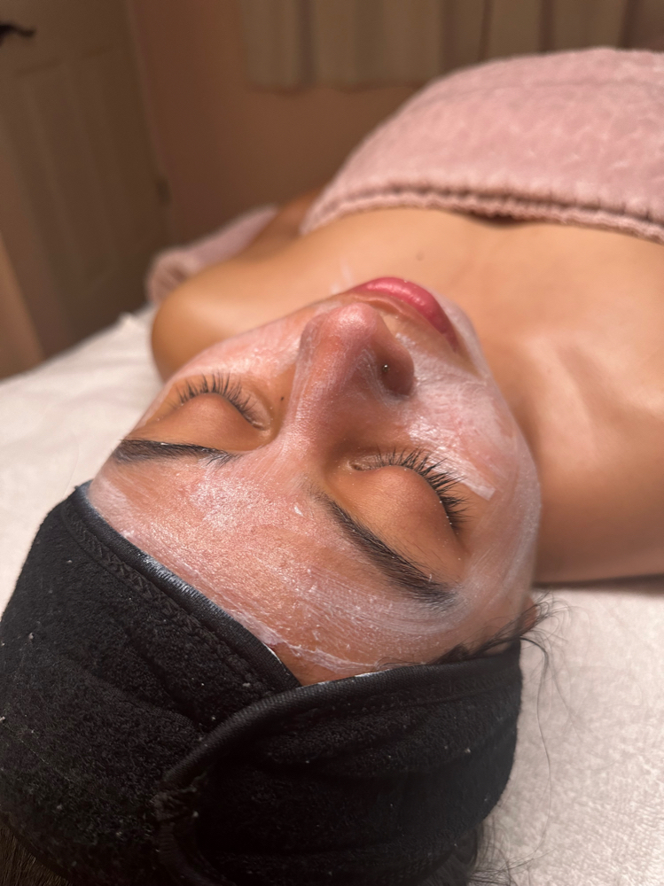 The Acne Facial